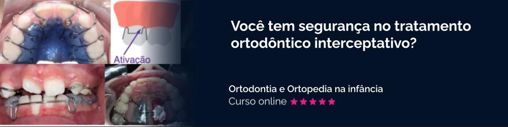 Você tem segurança no tratamento ortodôntico interceptivo?