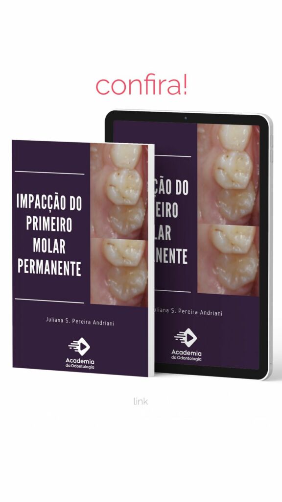 impacção