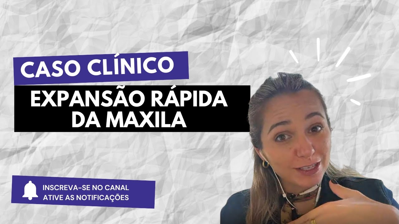 Caso clinico Expansão Rápida da Maxila 